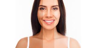 Skin Lightening Treatment